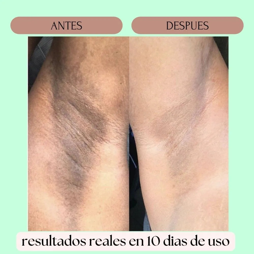 CREMA DESPIGMENTANTE DE RETINOL