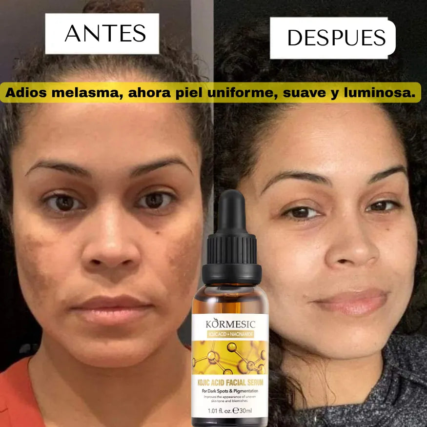 SERUM DESPIGMENTANTE E HIDRATANTE DE NIACINAMIDA Y ACIDO KOJICO
