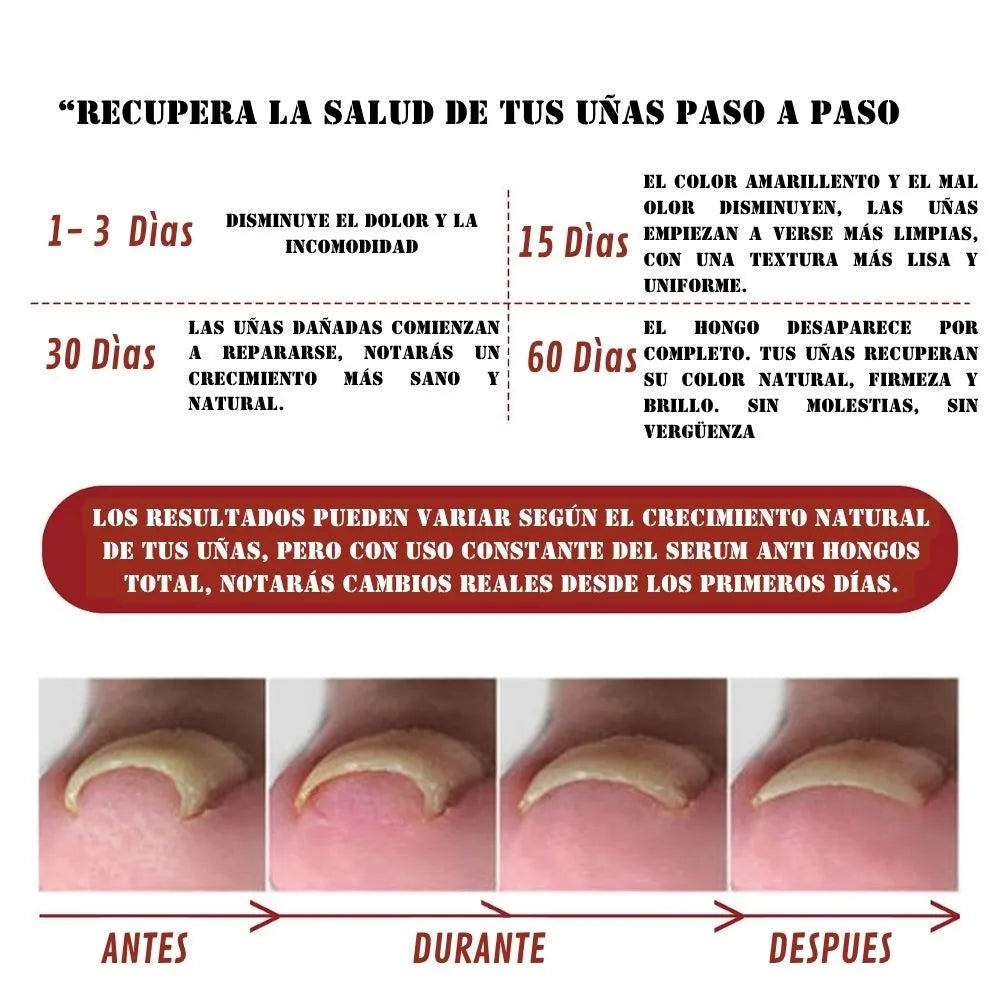 SERUM ANTI HONGOS TOTAL 2x1