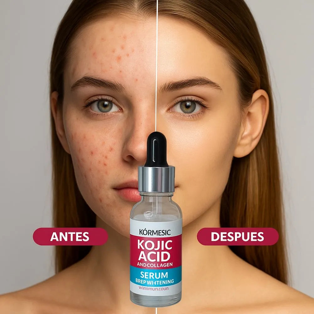 SERUM ANTIMANCHAS DE ÁCIDO KÓJICO Y COLÁGENO