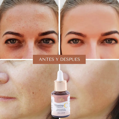 VITAMINA C + VITAMINA E ALMA COSMETIC