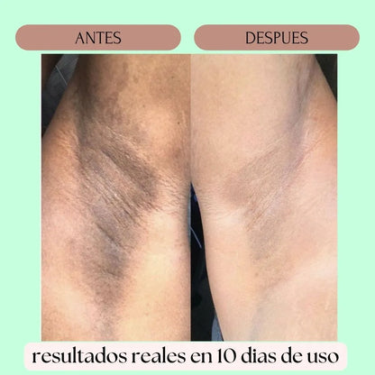 CREMA DESPIGMENTANTE DE RETINOL