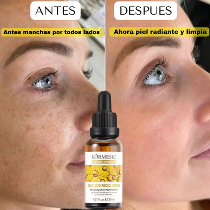 SERUM DESPIGMENTANTE E HIDRATANTE DE NIACINAMIDA Y ACIDO KOJICO