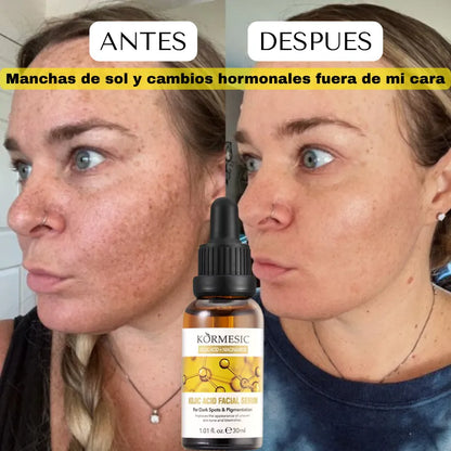 SERUM DESPIGMENTANTE E HIDRATANTE DE NIACINAMIDA Y ACIDO KOJICO