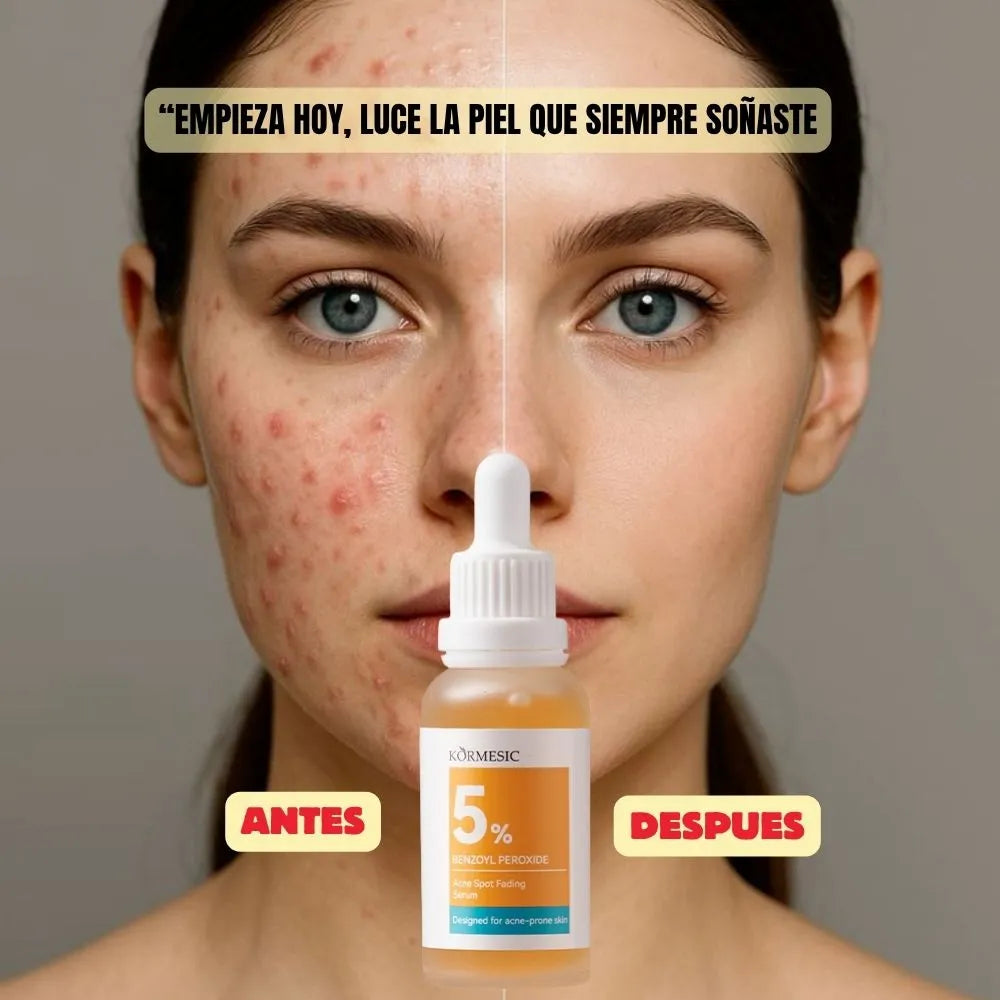 SERUM  ACLARANTE DE MANCHAS DE ACNE