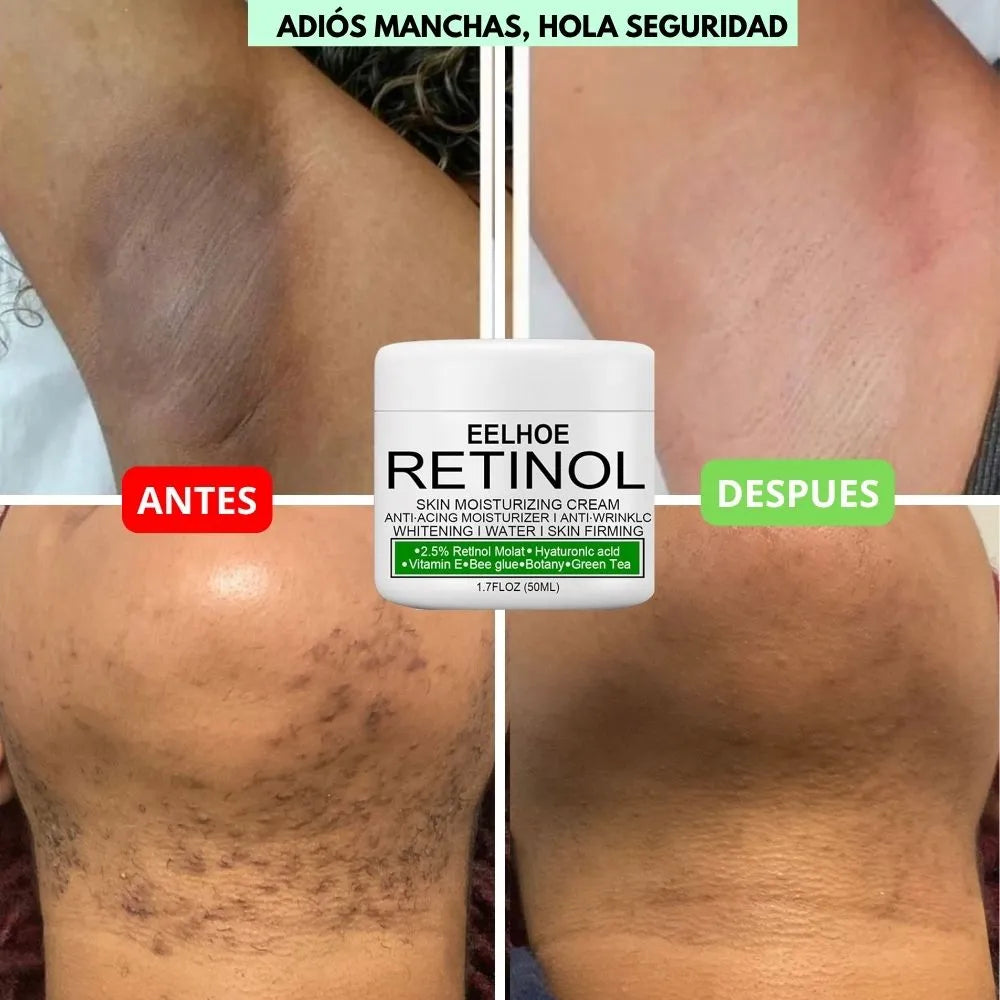 CREMA DESPIGMENTANTE DE RETINOL