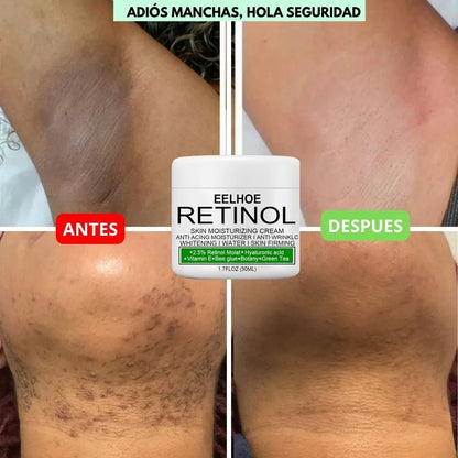 CREMA DESPIGMENTANTE DE RETINOL