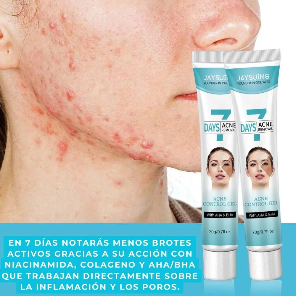 Gel anti acné y manchas