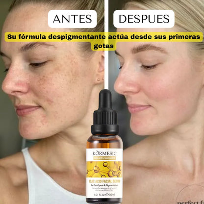 SERUM DESPIGMENTANTE E HIDRATANTE DE NIACINAMIDA Y ACIDO KOJICO