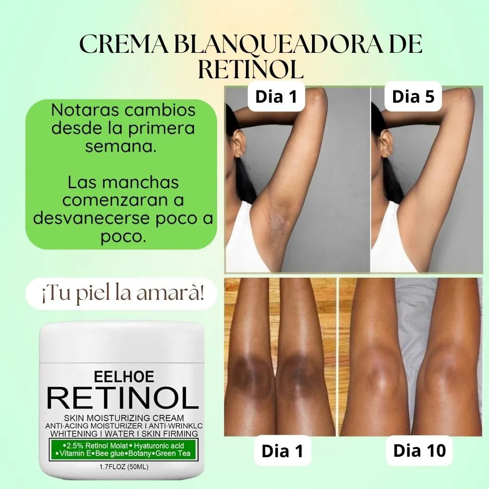 CREMA DESPIGMENTANTE DE RETINOL
