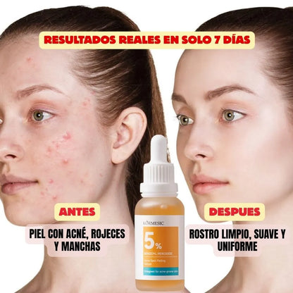 SERUM  ACLARANTE DE MANCHAS DE ACNE