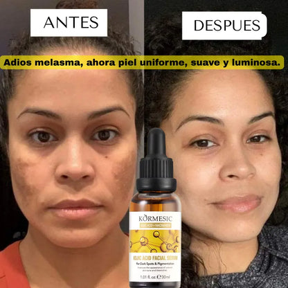 SERUM DESPIGMENTANTE E HIDRATANTE DE NIACINAMIDA Y ACIDO KOJICO