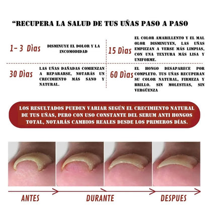 SERUM ANTI HONGOS TOTAL 2x1