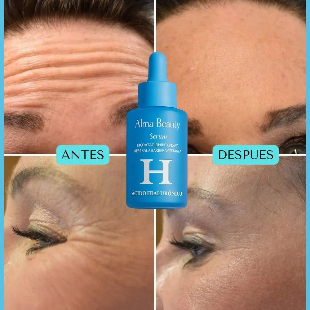 SERUM ACIDO HIALURONICO ALMA BEAUTY