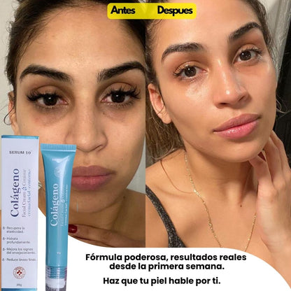 CONTORNO DE OJOS DE COLAGENO Y ACIDO HIALURONICO.