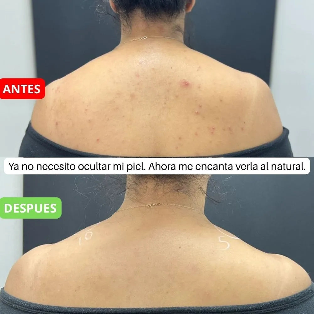 CREMA DESPIGMENTANTE DE RETINOL