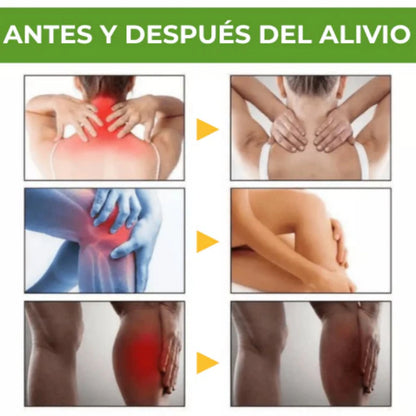 2x1 crema Beevana para Dolores, Articulaciones, Inflamaciòn