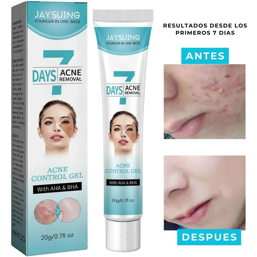 Gel anti acné y manchas