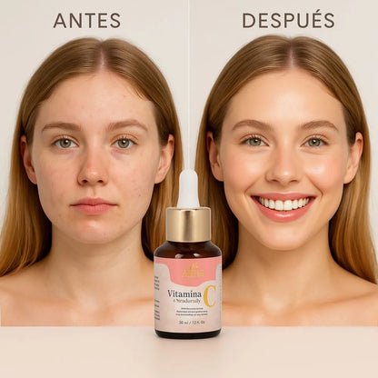 VITAMINA C + VITAMINA E ALMA COSMETIC