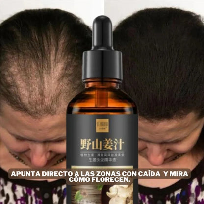 SERUM DE JENGIBRE PARA CRECIMIENTO DE CABELLO