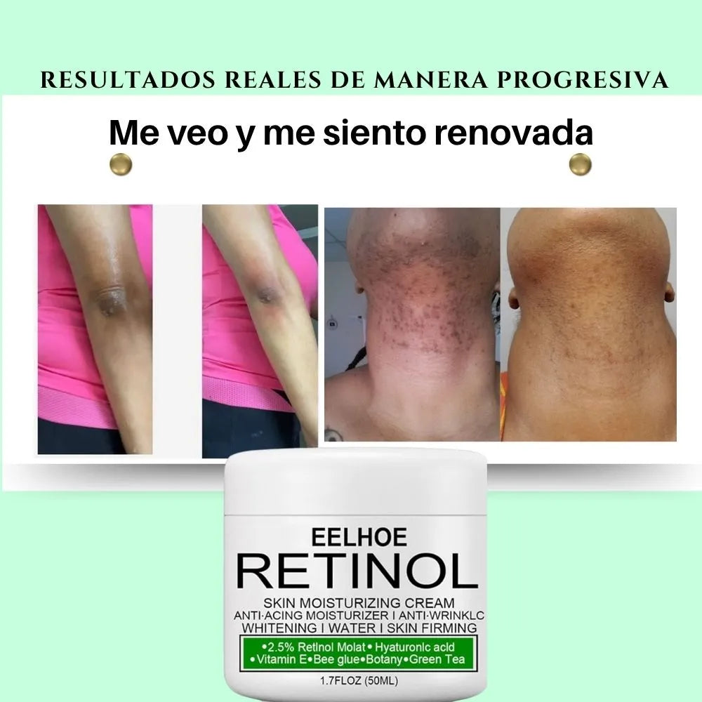CREMA DESPIGMENTANTE DE RETINOL