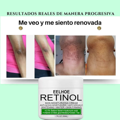 CREMA DESPIGMENTANTE DE RETINOL