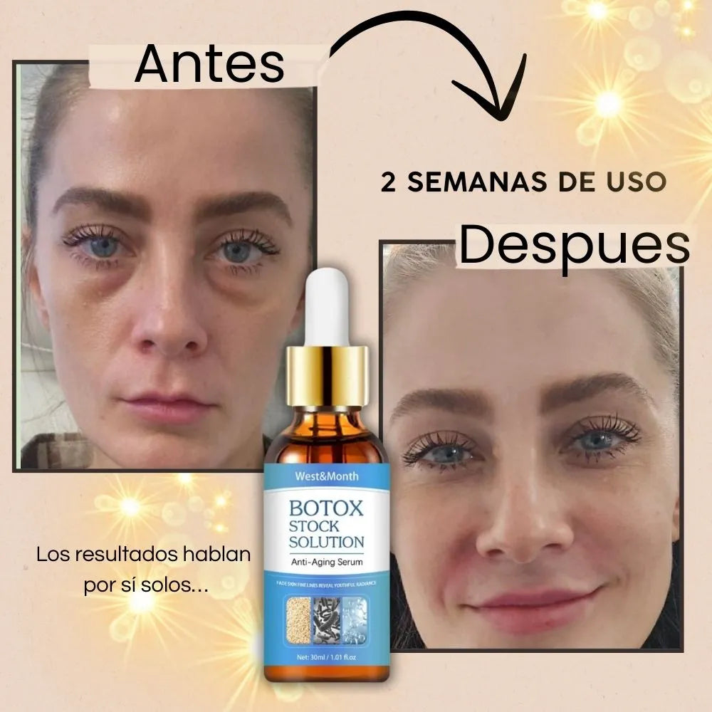 Serum Botox Antiarrugas