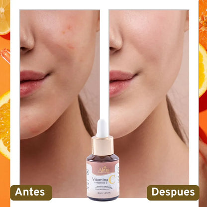 VITAMINA C + VITAMINA E ALMA COSMETIC