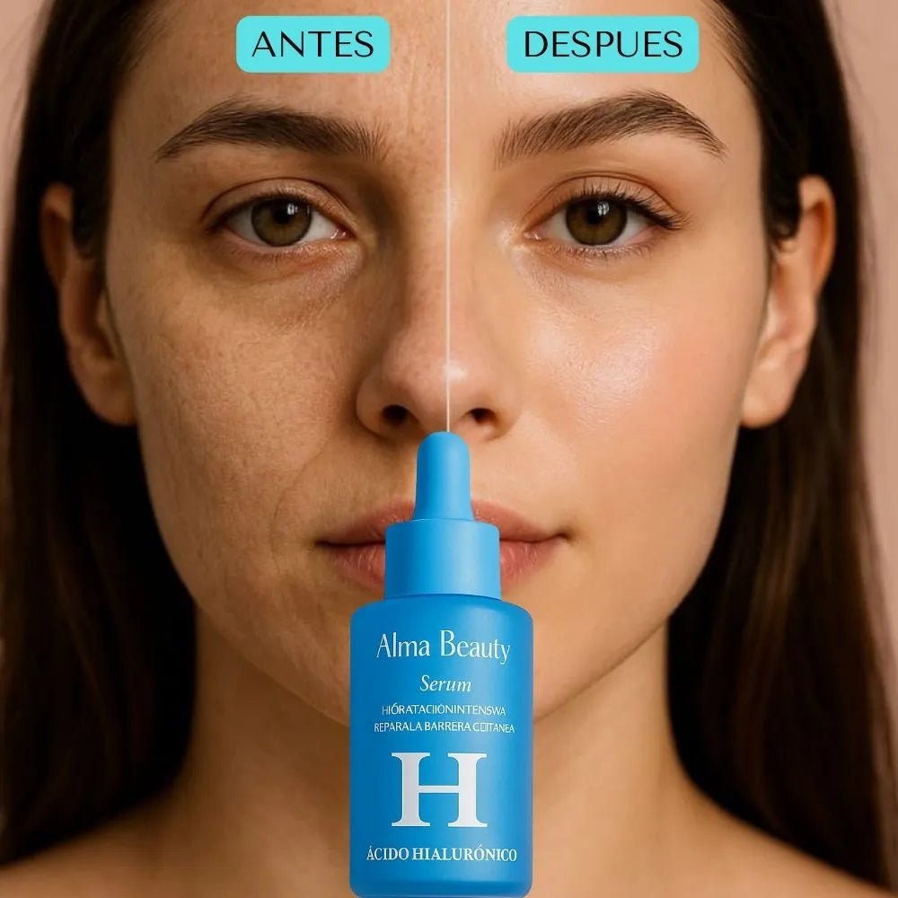 SERUM ACIDO HIALURONICO ALMA BEAUTY