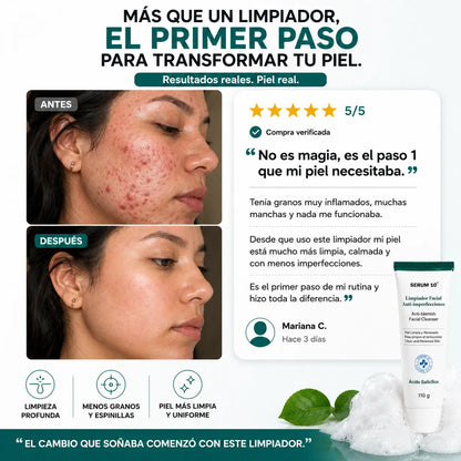 LIMPIADOR ANTI ACNE Y MANCHAS DE NIACINAMIDA,ACIDO SALICILICO Y GLICOLICO