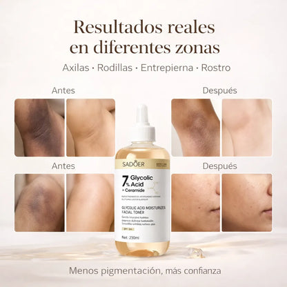 Acido Glycolico +ceramidas