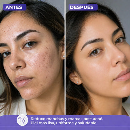 CREMA ACLARANTE DE NIACINAMIDA