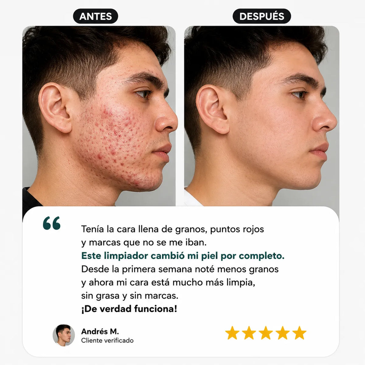 LIMPIADOR ANTI ACNE Y MANCHAS DE NIACINAMIDA,ACIDO SALICILICO Y GLICOLICO