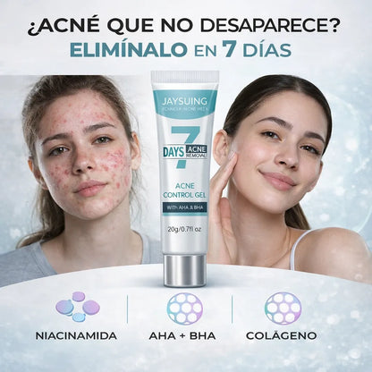 Gel anti acné y manchas