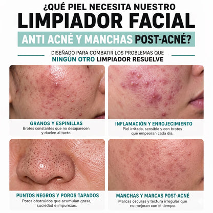 LIMPIADOR ANTI ACNE Y MANCHAS DE NIACINAMIDA,ACIDO SALICILICO Y GLICOLICO